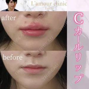 L‘amour clinic Tokyo【ラムールクリニック東京】の症例