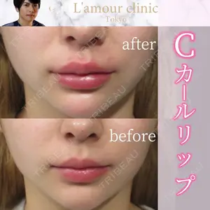 L‘amour clinic Tokyo【ラムールクリニック東京】の症例