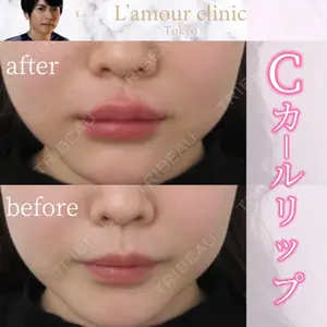 L‘amour clinic Tokyo【ラムールクリニック東京】の症例