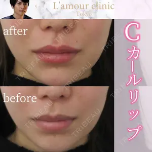 L‘amour clinic Tokyo【ラムールクリニック東京】の症例