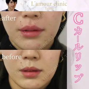 L‘amour clinic Tokyo【ラムールクリニック東京】の症例