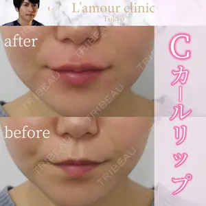 L‘amour clinic Tokyo【ラムールクリニック東京】の症例