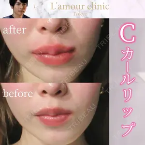 L‘amour clinic Tokyo【ラムールクリニック東京】の症例