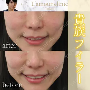 L‘amour clinic Tokyo【ラムールクリニック東京】の症例