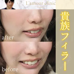 L‘amour clinic Tokyo【ラムールクリニック東京】の症例