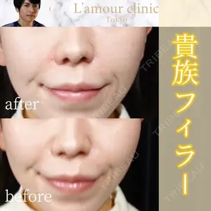 L‘amour clinic Tokyo【ラムールクリニック東京】の症例