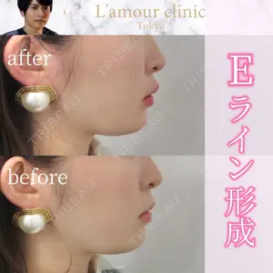 L‘amour clinic Tokyo【ラムールクリニック東京】の症例