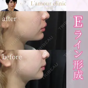 L‘amour clinic Tokyo【ラムールクリニック東京】の症例