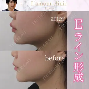 L‘amour clinic Tokyo【ラムールクリニック東京】の症例