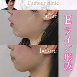 L‘amour clinic Tokyo【ラムールクリニック東京】の症例