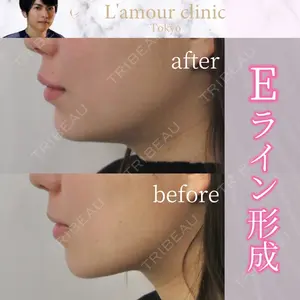 L‘amour clinic Tokyo【ラムールクリニック東京】の症例