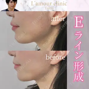 L‘amour clinic Tokyo【ラムールクリニック東京】の症例