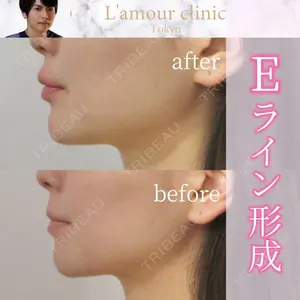 L‘amour clinic Tokyo【ラムールクリニック東京】の症例