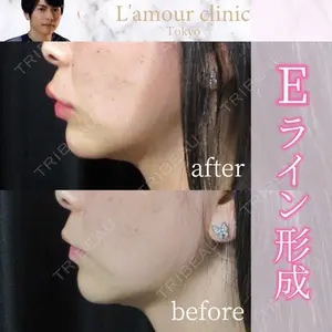 L‘amour clinic Tokyo【ラムールクリニック東京】の症例