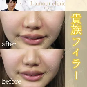 L‘amour clinic Tokyo【ラムールクリニック東京】の症例