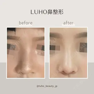 LUHO（ルホ）美容外科の症例
