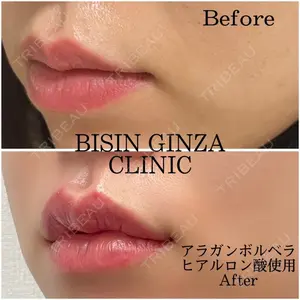 BISIN GINZA CLINICの症例