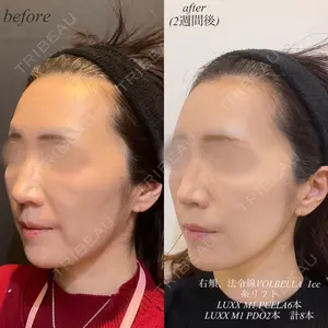DMTC美容皮膚科 渋谷院 山中大介医師の症例