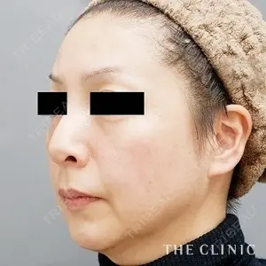 THE CLINIC（ザ・クリニック）東京院の症例