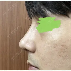 LUHO（ルホ）美容外科 キム・ジュンヨン医師の症例