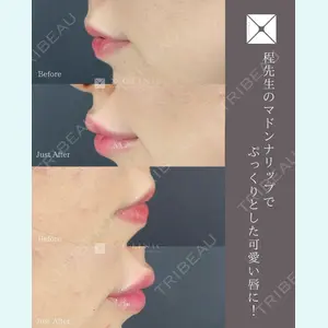 X CLINIC 銀座院 程 璐医師の症例