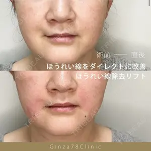 Ginza 78 Clinic 浅野 秀樹医師の症例