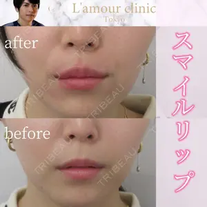 L‘amour clinic Tokyo【ラムールクリニック東京】の症例