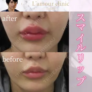 L‘amour clinic Tokyo【ラムールクリニック東京】の症例