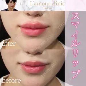 L‘amour clinic Tokyo【ラムールクリニック東京】の症例