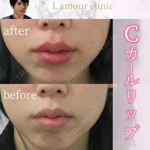 L‘amour clinic Tokyo【ラムールクリニック東京】の症例