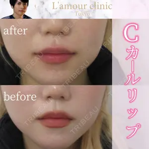 L‘amour clinic Tokyo【ラムールクリニック東京】の症例