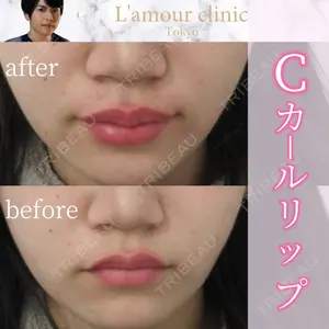 L‘amour clinic Tokyo【ラムールクリニック東京】の症例