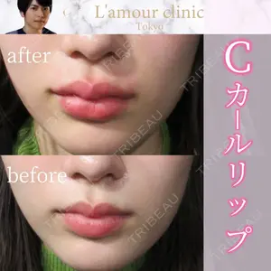 L‘amour clinic Tokyo【ラムールクリニック東京】の症例