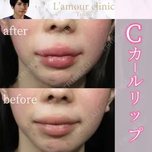 L‘amour clinic Tokyo【ラムールクリニック東京】の症例