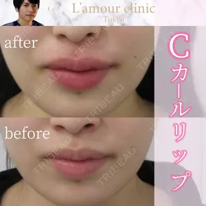 L‘amour clinic Tokyo【ラムールクリニック東京】の症例