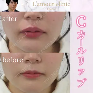 L‘amour clinic Tokyo【ラムールクリニック東京】の症例