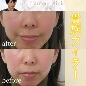 L‘amour clinic Tokyo【ラムールクリニック東京】の症例