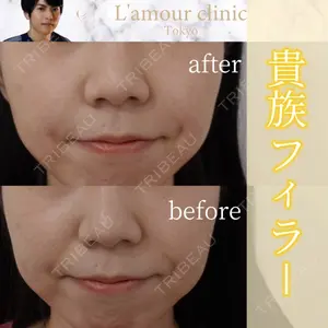 L‘amour clinic Tokyo【ラムールクリニック東京】の症例