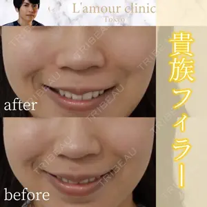 L‘amour clinic Tokyo【ラムールクリニック東京】の症例