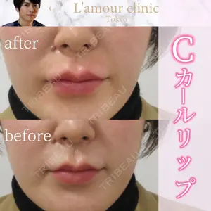 L‘amour clinic Tokyo【ラムールクリニック東京】の症例
