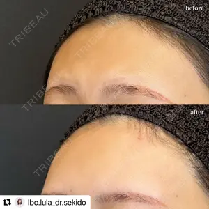 ルラ美容クリニック 名古屋栄院 / ルラスキンクリニック 名古屋栄院 関戸 優医師の症例