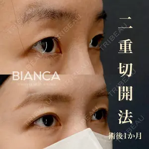 BIANCA銀座 雜賀 俊行医師の症例
