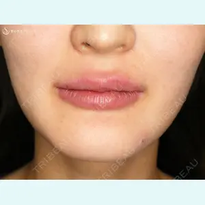 聖心美容クリニック 福岡院の症例