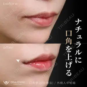 Otus Clinic 【オータスクリニック】 中 徳太郎医師の症例