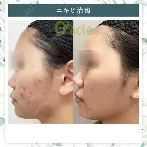 オラクル美容皮膚科 名古屋院の症例