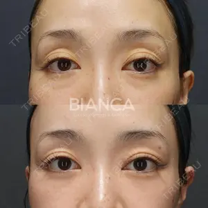 BIANCA表参道 松田 朋子医師の症例