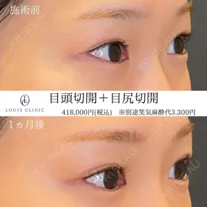LOUIS CLINIC 二子玉川院【ルイクリニック】 小松 塁医師の症例