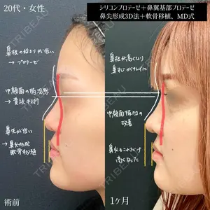 東京シンデレラ美容外科 大宮院 髙田 怜医師の症例