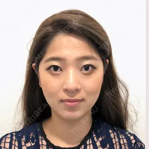 A CLINIC（エークリニック） 横浜院 柴田 貴志医師の症例
