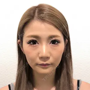 A CLINIC（エークリニック） 横浜院 柴田 貴志医師の症例